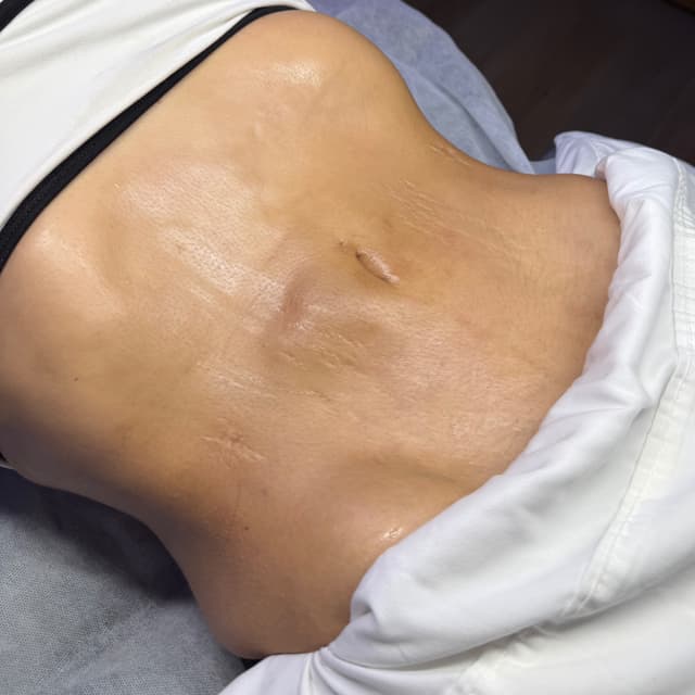 SIX PACK at AaliyahxSkin in Denver, CO